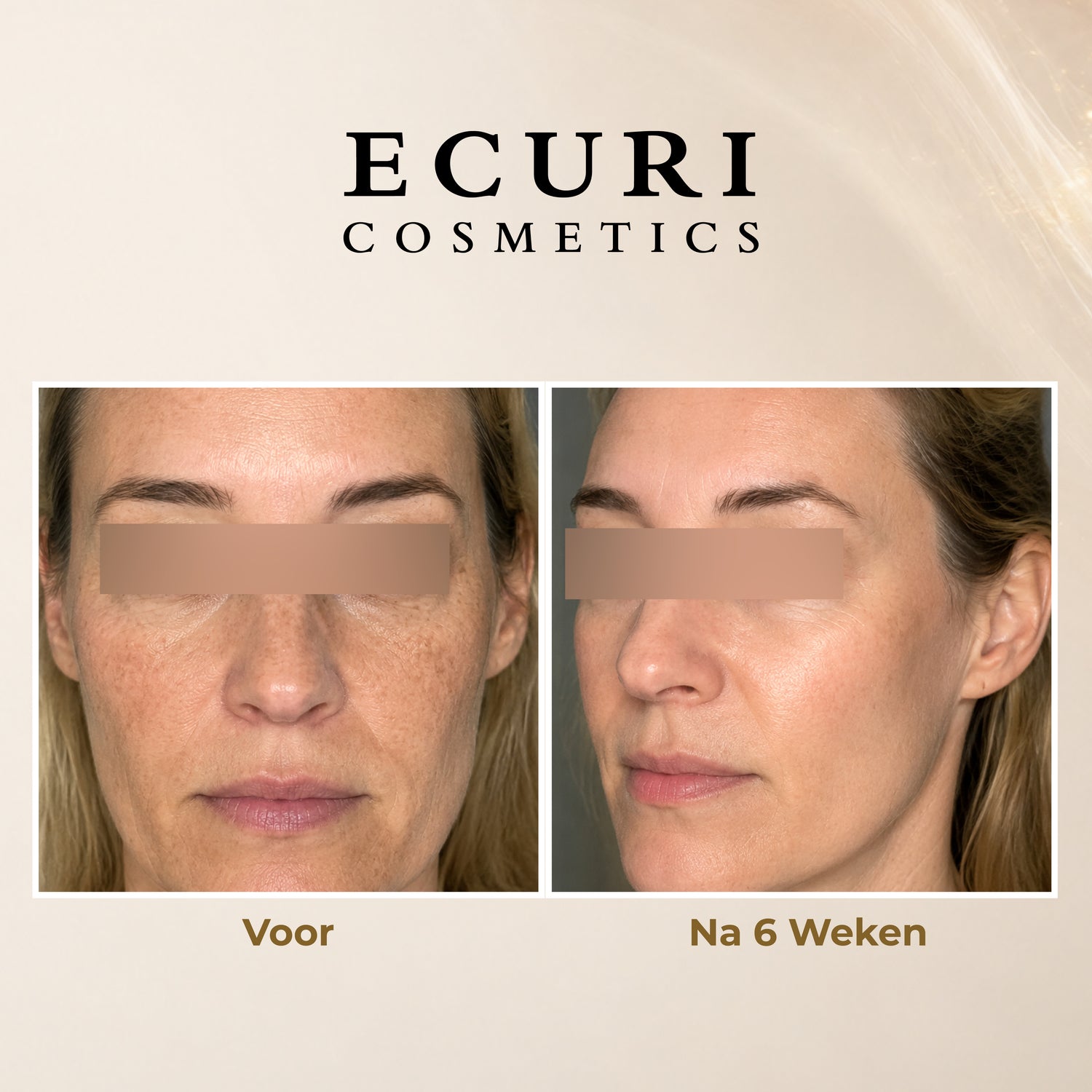 Vitamine A Retinol 0,5% Thuis gebruik