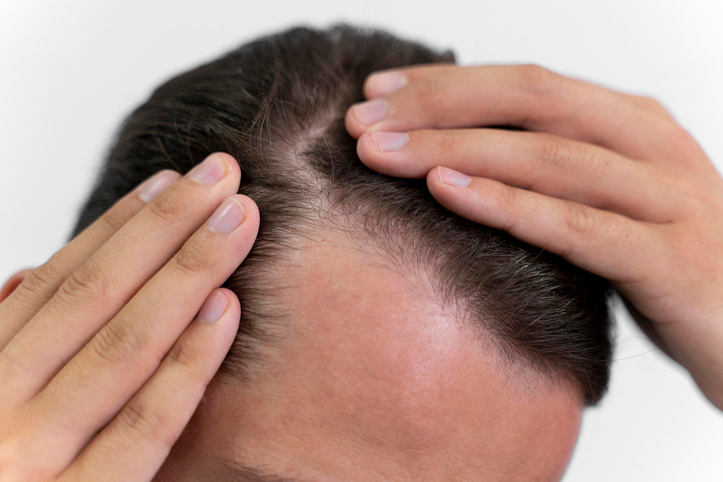 Hoe krijg ik dikker en voller haar?