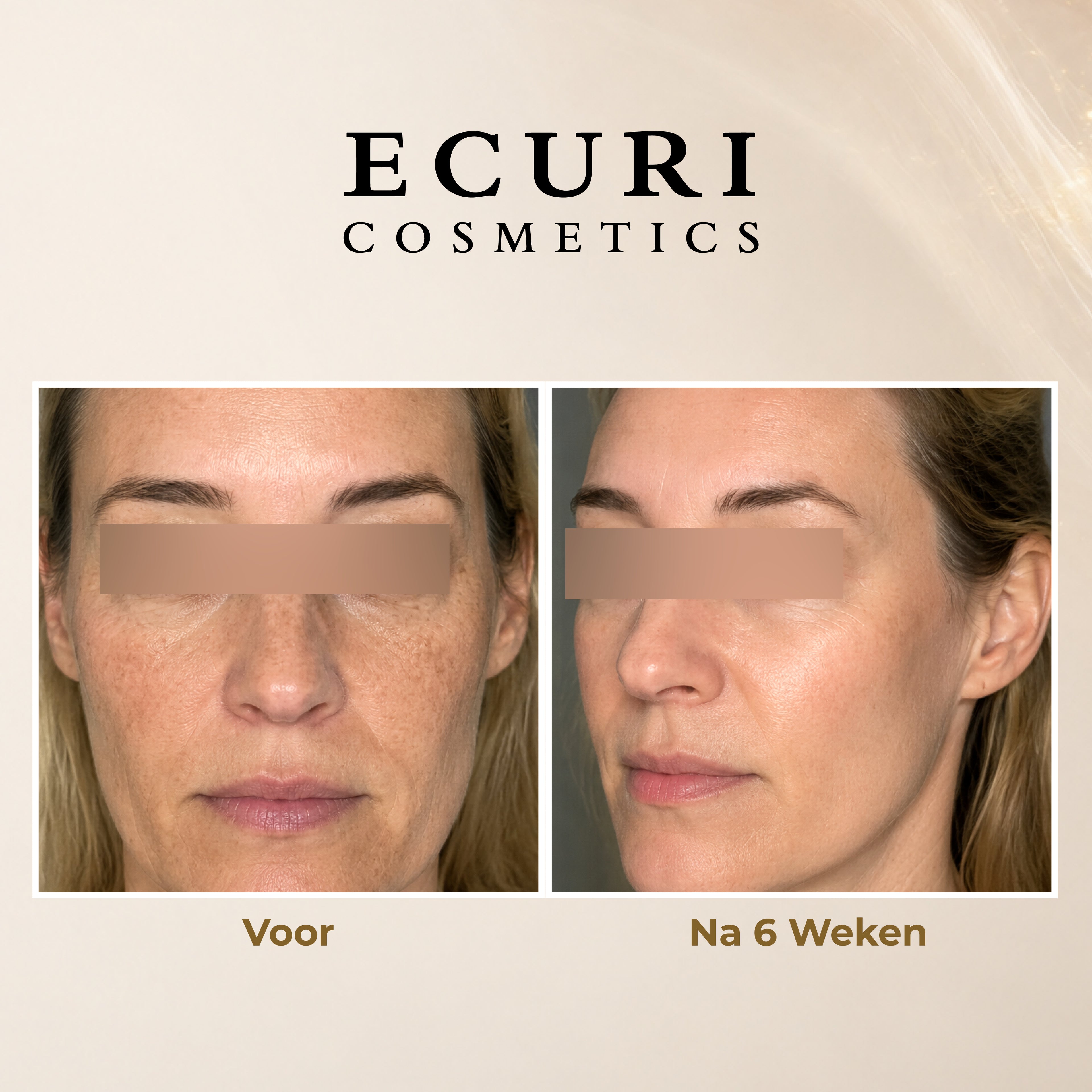 Vitamine A Retinol 0,5% Thuis gebruik