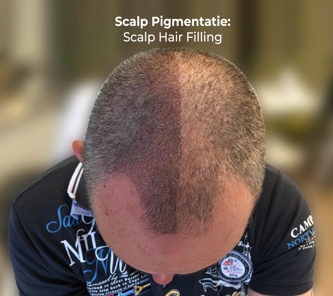 Scalp Training All Round 4 Day - 3 November 2025