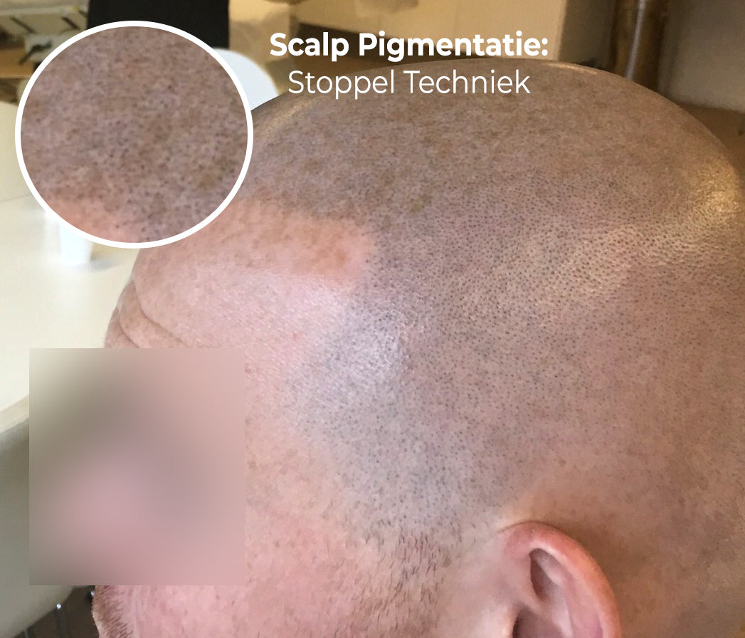 Scalp Training 1 Day - 3 November 2025