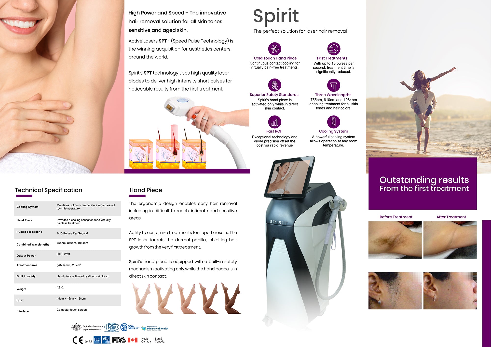 Spirit Laser Hair Removal (Made in Israel)